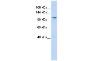 Western Blotting (WB) image for anti-Zinc Finger, MIZ-Type Containing 1 (ZMIZ1) (N-Term) antibody (ABIN927803)