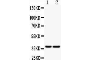 Western Blotting (WB) image for anti-B-cell antigen receptor complex-associated protein alpha chain (CD79A) (AA 121-226) antibody (ABIN3043397) (CD79a antibody  (AA 121-226))