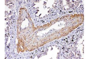 IHC analysis of VEGF Receptor 2  using anti-VEGF Receptor 2  antibody .