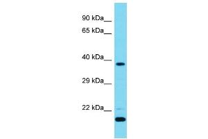 Host: Rabbit  Target Name: Camk1d  Sample Tissue: Mouse Testis lysates  Antibody Dilution: 1. (CAMK1D antibody  (N-Term))