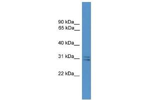 WB Suggested Anti-SNAP29 Antibody Titration: 0. (SNAP29 antibody  (Middle Region))