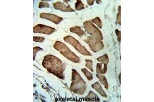Immunohistochemistry (IHC) image for anti-Leiomodin 1 (LMOD1) antibody (ABIN3003829) (Leiomodin 1 antibody)