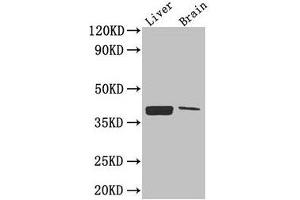 Western Blot Positive WB detected in: Mouse liver tissue, Mouse brain tissue All lanes: CXCR4 antibody at 2. (CXCR4 antibody  (AA 1-356))