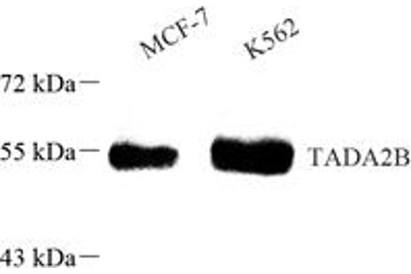 TADA2B anticorps