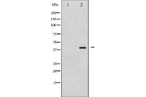 Western Blotting (WB) image for anti-Nucleophosmin (Nucleolar phosphoprotein B23, Numatrin) (NPM1) (pThr199) antibody (ABIN6256499)