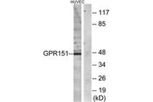 Western blot analysis of extracts from HuvEc cells, using GPR151 Antibody. (GPR151 antibody  (AA 276-325))