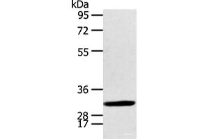 Western blot analysis of Human fetal brian tissue using CALB2 Polyclonal Antibody at dilution of 1:400 (Calretinin antibody)