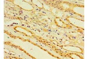 Immunohistochemistry of paraffin-embedded human kidney tissue using ABIN7151448 at dilution of 1:100 (EGLN3 antibody  (AA 1-120))