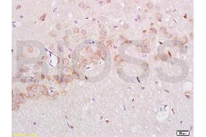 Immunohistochemistry (IHC) image for anti-Nerve Growth Factor Receptor (NGFR) (AA 301-400) antibody (ABIN725660) (NGFR antibody  (AA 301-400))