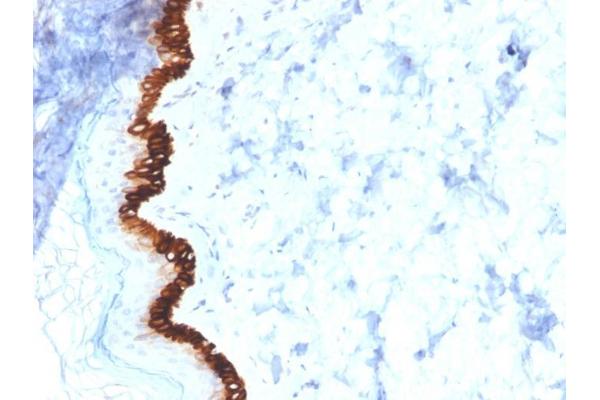 KRT15 antibody