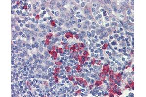 IHC-P Image Immunohistochemical analysis of paraffin-embedded human tonsil, plasma cells, using APP, antibody(10 μg/ml). (APP antibody  (C-Term))