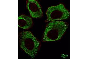 Immunofluorescent analysis of A549 cells, using TBB5 Antibody (ABIN387758 and ABIN2838008). (TUBB antibody)