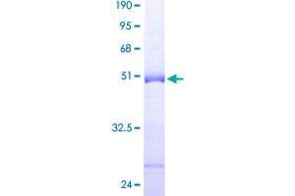 C9orf6 Protein (AA 1-181) (GST tag)