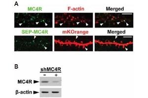 Expression of MC4R in mouse hippocampal neurons.