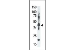 Western Blotting (WB) image for anti-Melanoma Antigen Family A, 4 (MAGEA4) (N-Term) antibody (ABIN358647)