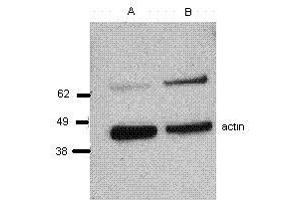 Image no. 1 for anti-Perforin 1 (Pore Forming Protein) (PRF1) antibody (ABIN477313) (Perforin 1 antibody)