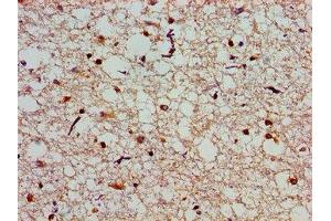Immunohistochemistry of paraffin-embedded human brain tissue using ABIN7146350 at dilution of 1:100 (SLC25A12 antibody  (AA 202-317))