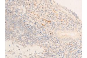 Immunohistochemistry (IHC) image for anti-Heat Shock Protein, alpha-Crystallin-Related, B6 (HSPB6) (pSer16) antibody (ABIN6256161)