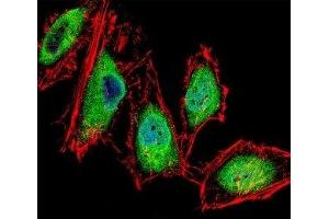 Fluorescent confocal image of HeLa cells stained with RUNX3 antibody.