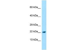 WB Suggested Anti-PPIL1 Antibody Titration: 1.