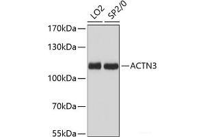 Western blot analysis of extracts of various cell lines using ACTN3 Polyclonal Antibody at dilution of 1:3000. (ACTN3 antibody)