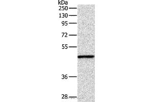 Western blot analysis of Mouse fat tissue, using INHBA Polyclonal Antibody at dilution of 1:1000 (INHBA antibody)