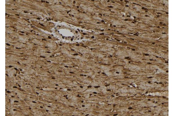KIFC1 antibody  (Internal Region)