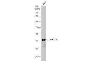 WB Image GNAT2 antibody detects GNAT2 protein by western blot analysis.