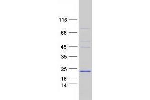 Validation with Western Blot (PRDM7 Protein (Transcript Variant 2) (Myc-DYKDDDDK Tag))