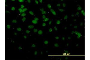 Immunofluorescence of monoclonal antibody to DMTF1 on HeLa cell. (DMP1 antibody  (AA 661-760))