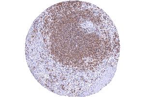 Spleen with strong CD38B staining of B lymphocytes forming the white pulpa