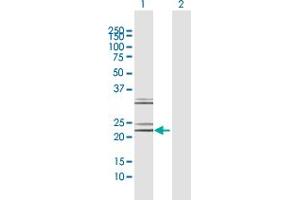 Western Blot analysis of NTF4 expression in transfected 293T cell line by NTF4 MaxPab polyclonal antibody. (Neurotrophin 4 antibody  (AA 1-210))