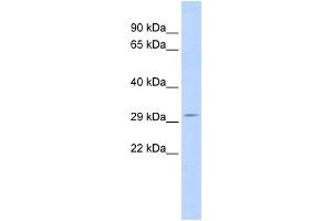 WB Suggested Anti-SCOTIN Antibody Titration:  0. (SHISA5 antibody  (Middle Region))