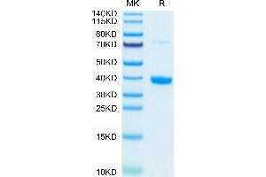 Mouse MFAP4 on Tris-Bis PAGE under reduced condition. (MFAP4 Protein (AA 23-257) (His-DYKDDDDK Tag))