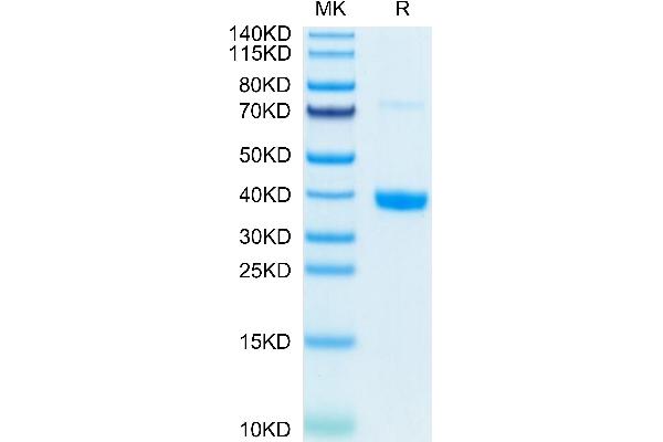 MFAP4 Protein (AA 23-257) (His-DYKDDDDK Tag)