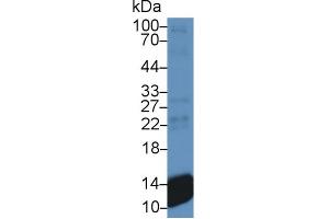 Western Blot; Sample: Human Platelet lysate; Primary Ab: 300 Mouse Anti-Human bTG Antibody Second Ab: 0. (CXCL7 antibody  (AA 59-128))
