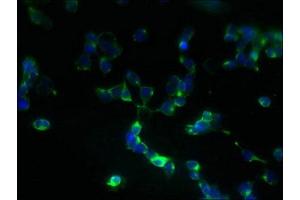 Immunofluorescence (IF) image for anti-Zinc Finger, DHHC-Type Containing 5 (ZDHHC5) (AA 231-500) antibody (ABIN7162554)