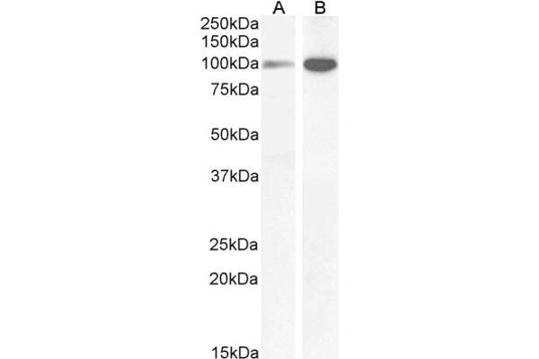 GRIN1/NMDAR1 antibody  (Internal Region)