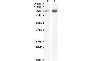 ABIN185678 (1µg/ml) staining of Human Amylgada (A) and Rat (B) Brain lysate (35µg protein in RIPA buffer).
