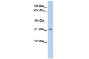 Image no. 1 for anti-N-Methylpurine-DNA Glycosylase (MPG) (C-Term) antibody (ABIN6740899)