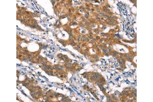 Immunohistochemistry (IHC) image for anti-Cylindromatosis (Turban Tumor Syndrome) (CYLD) antibody (ABIN5549821)