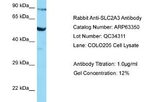 Western Blotting (WB) image for anti-Solute Carrier Family 2 (Facilitated Glucose Transporter), Member 3 (SLC2A3) (Middle Region) antibody (ABIN2789461) (SLC2A3 antibody  (Middle Region))