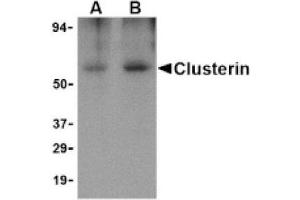 Image no. 1 for anti-Clusterin (CLU) (Isoform 1) antibody (ABIN265125) (Clusterin antibody  (Isoform 1))