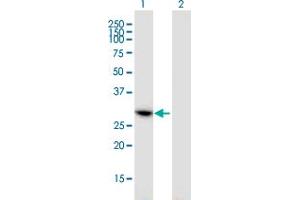 Western Blot analysis of CCDC5 expression in transfected 293T cell line by CCDC5 monoclonal antibody (M01), clone 1E3. (HAUS1 antibody  (AA 179-278))