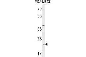 SYCE2 Antibody (N-term) western blot analysis in MDA-MB231 cell line lysates (35 µg/lane).