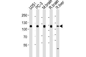 Western blot analysis of lysates from , PC-3 cell line, mouse brain, rat brain and liver tissue lysates (from left to right), using USP5 Antibody (ABIN1944895 and ABIN2838537).