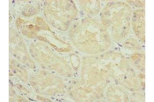 Immunohistochemistry of paraffin-embedded human kidney tissue using ABIN7154838 at dilution of 1:100 (NYS48/HAUS8 antibody  (AA 166-410))