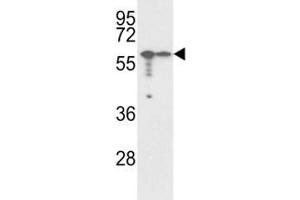 Western blot analysis of VIM antibody and A2058, A375 lysate.