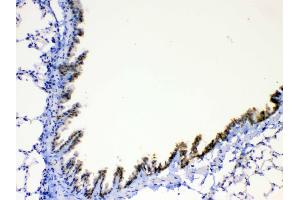 IHC analysis of AGRP using anti-AGRP antibody . (AGRP antibody  (AA 82-131))