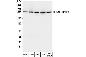 Western Blotting (WB) image for anti-Small Nuclear Ribonucleoprotein 200kDa (U5) (SNRNP200) (AA 400-450) antibody (ABIN7454918) (SNRNP200 antibody  (AA 400-450))